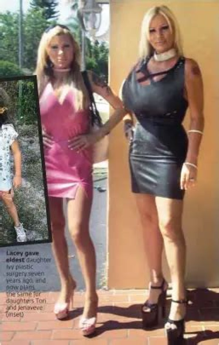 
Lacey Wildd Plastic Surgery Before And After, Where Is She Now? 